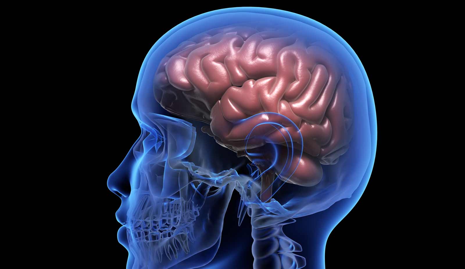 Hidrocefalia: cómo reconocer los síntomas y opciones de tratamiento para esta afección neurológica