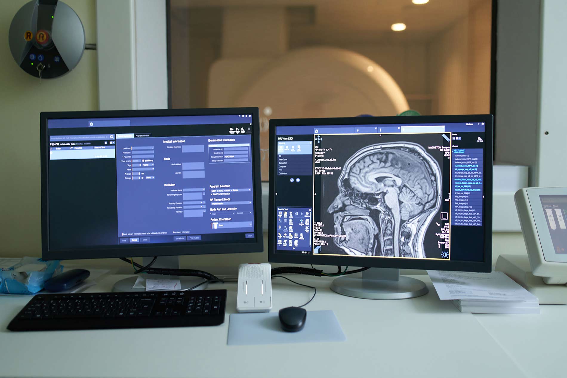 La neurocirugía del futuro: cómo la tecnología está revolucionando los procedimientos cerebrales