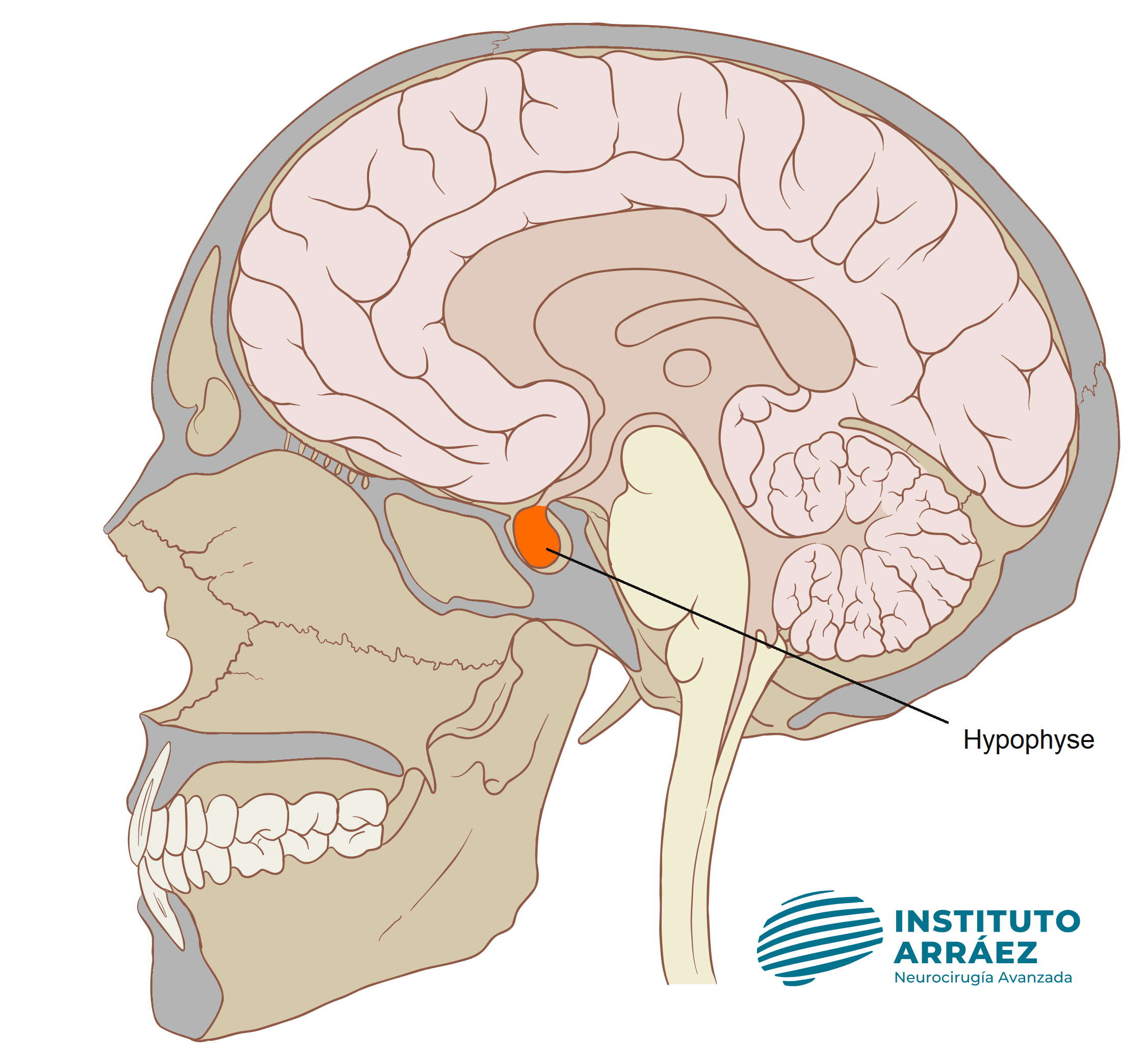 Tratamiento de tumores de hipófisis en Málaga